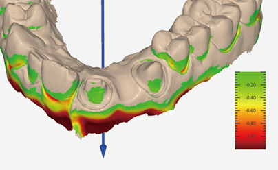 Rapid 3 Intraoral Scanner